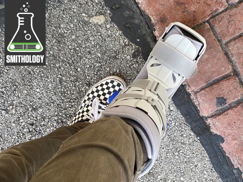 Smithology Broken Foot in boot lede